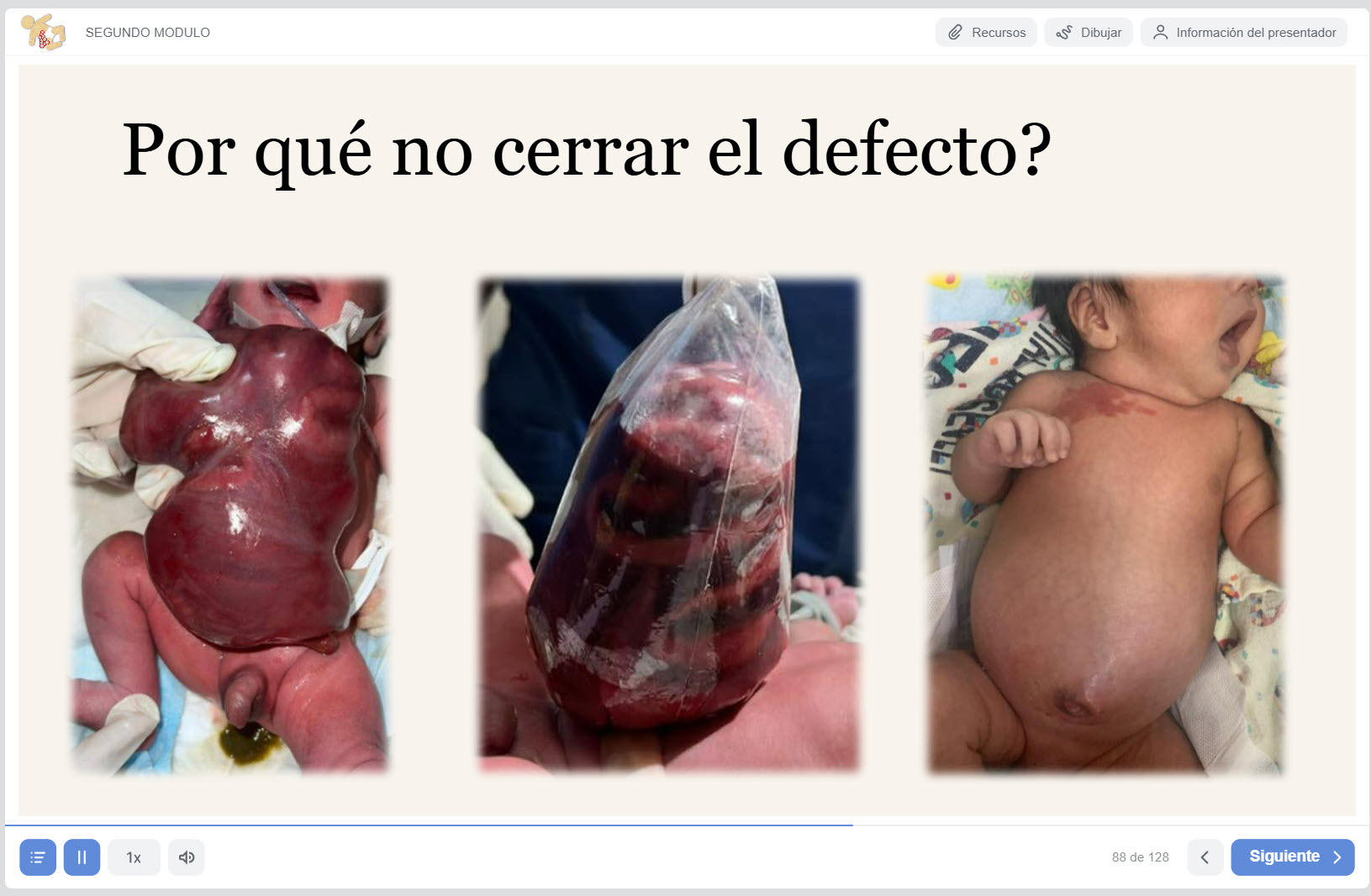 Módulo 2 manejo perinatal